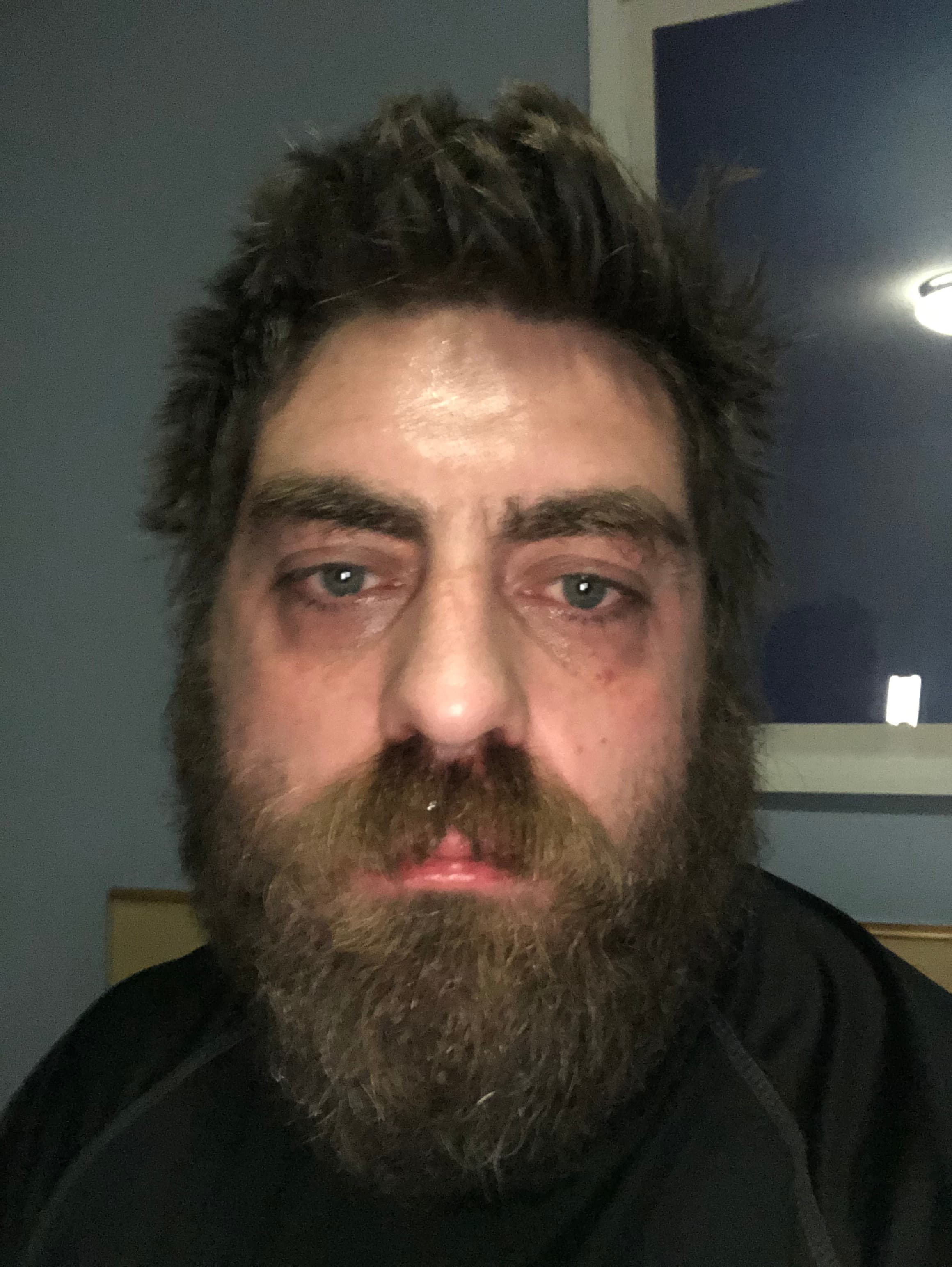 Mark Bragg - during addiction, in the darkness