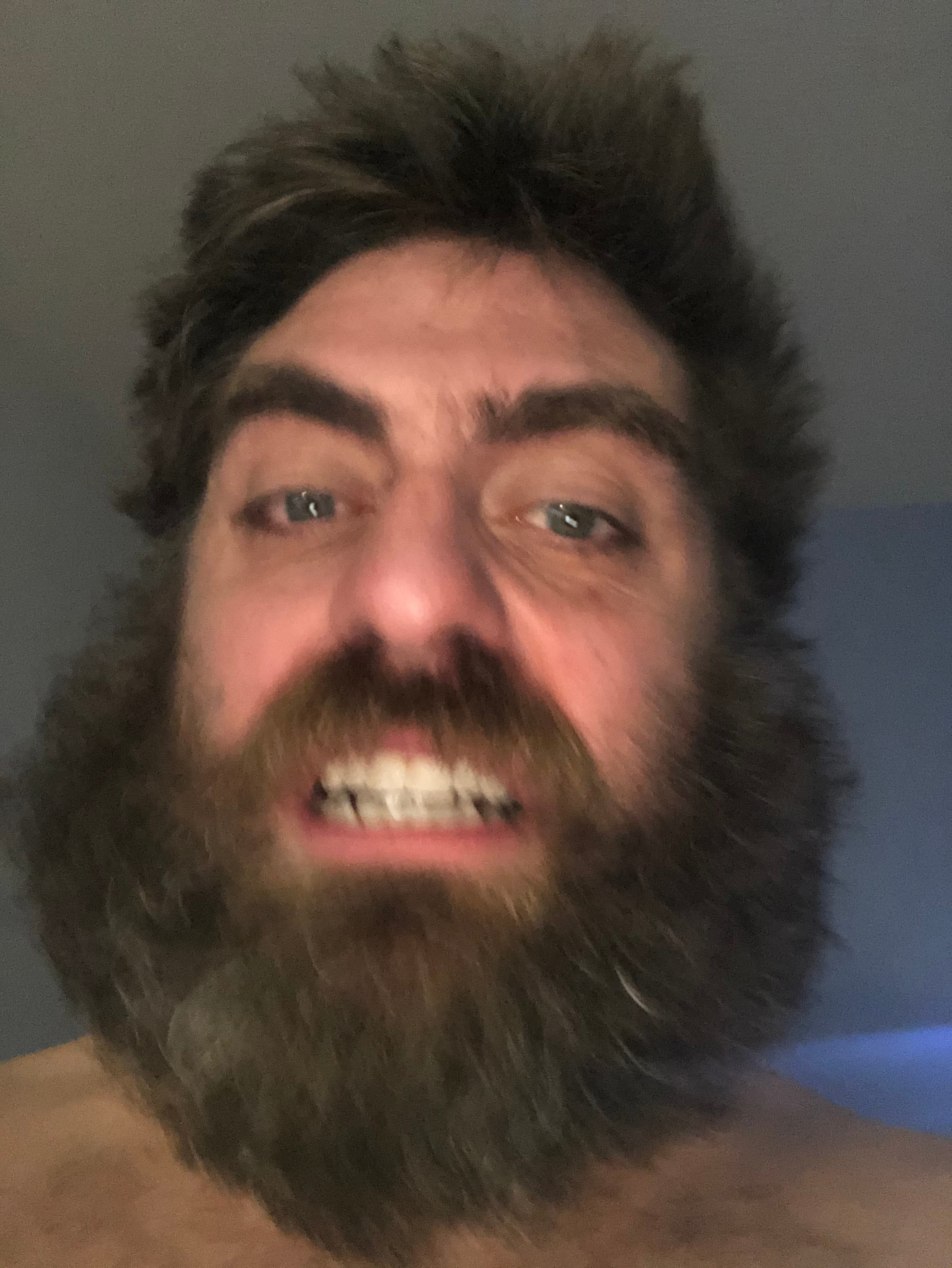 Mark Bragg - early recovery, first smile