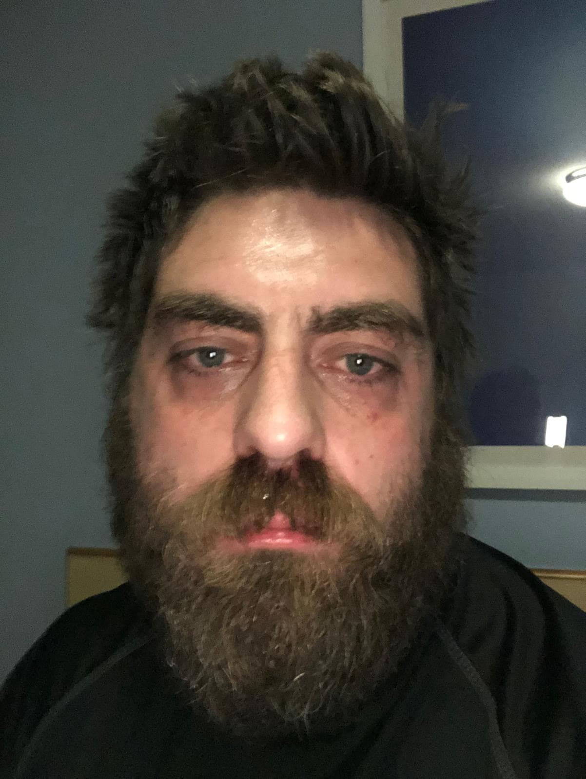 Mark during his darkest days